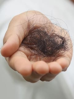 ਗਰਮੀਆਂ ‘ਚ ਵਾਲਾਂ ਦੇ ਝੜਨ ਨੂੰ ਕਿਵੇਂ ਰੋਕਿਆ ਜਾਵੇ?...