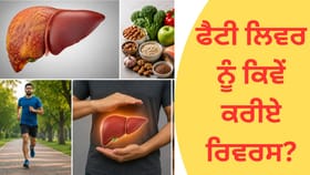 Fatty Liver Reverse: ਫੈਟੀ ਲਿਵਰ ਨੂੰ ਕੀਤਾ ਜਾ ਸਕਦਾ ਹੈ ਰਿਵਰਸ, ਅੱਜ ਹੀ ਰੁਟੀਨ 'ਚ ਇਨ੍ਹਾਂ ਆਦਤਾਂ ਨੂੰ ਅਪਣਾਓ