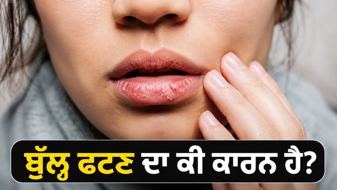 ਵਾਰ-ਵਾਰ ਫਟ ਰਹੇ ਹਨ ਬੁੱਲ੍ਹ? ਸਰੀਰ ਵਿੱਚ ਹੋ ਸਕਦੀ ਹੈ ਇਹ ਪੋਸ਼ਕ ਤੱਤਾਂ ਦੀ ਕਮੀ