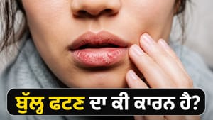 ਵਾਰ-ਵਾਰ ਫਟ ਰਹੇ ਹਨ ਬੁੱਲ੍ਹ? ਸਰੀਰ ਵਿੱਚ ਹੋ ਸਕਦੀ ਹੈ ਇਹ ਪੋਸ਼ਕ ਤੱਤਾਂ ਦੀ ਕਮੀ