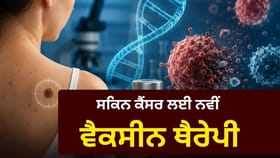 ਹੁਣ ਮੁੜ ਨਹੀਂ ਹੋਵੇਗਾ ਸਕਿਨ ਕੈਂਸਰ? ਆਈ ਨਵੀਂ ਪਰਸਨਲਾਈਜ਼ਡ ਵੈਕਸੀਨ ਥੈਰੇਪੀ
